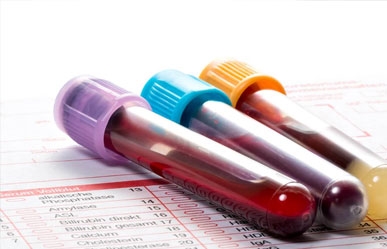 Blood & Laboratory Test